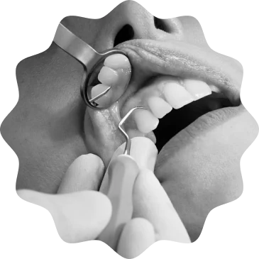 Close-up of a dental examination